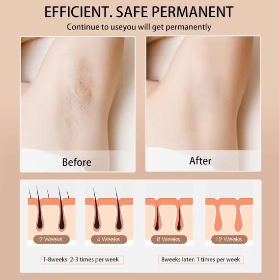 Babyverse - Digital IPL Hair Removal Device