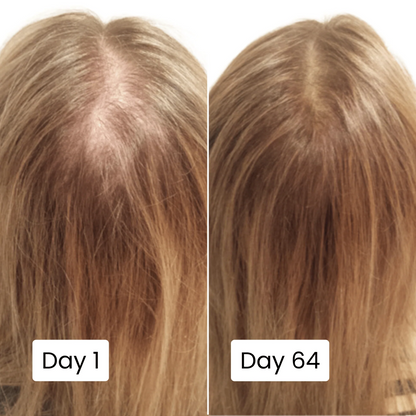 Scalp Hair Growth Serum